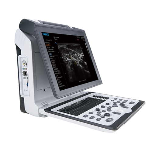 УЗИ аппарат SIUI Apogee 1100_69d3af338c3f7.jpeg УЗИ аппарат SIUI Apogee 1100 — изображение 1