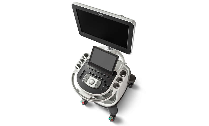 УЗИ-сканер Philips Affiniti 70_69db496125343.jpeg УЗИ-сканер Philips Affiniti 70 — изображение 2